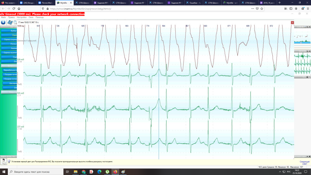 СПб Школа кардиологов 2019. Предшкольное обучение и конкурс по расшифровке  холтеровских мониторов. - Страница 5 - Весенняя школа - Аритмологический  форум
