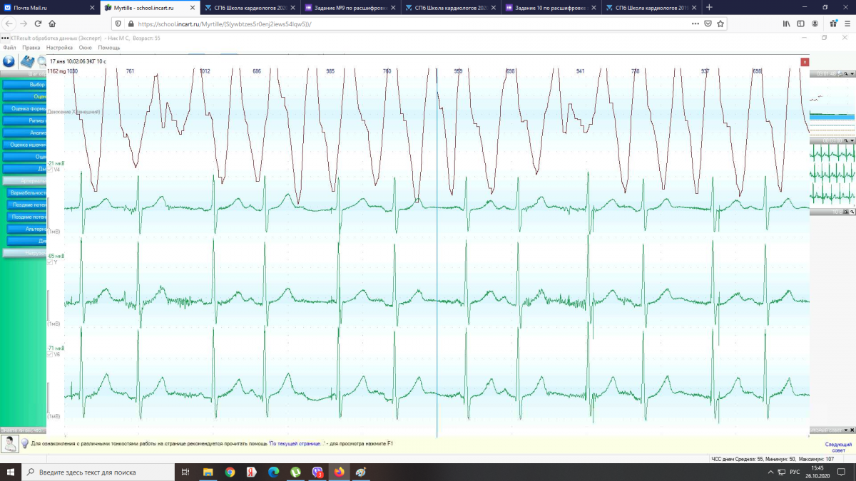 СПб Школа кардиологов 2019. Предшкольное обучение и конкурс по расшифровке  холтеровских мониторов. - Страница 5 - Весенняя школа - Аритмологический  форум